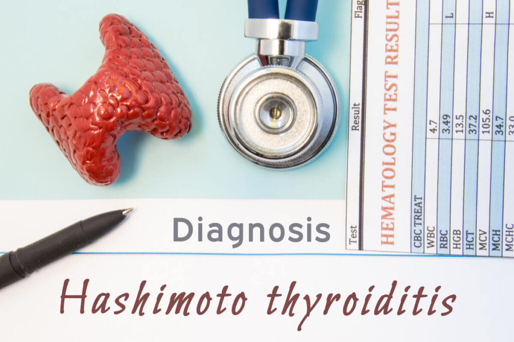 Hypothyroidism Blog Photo 3